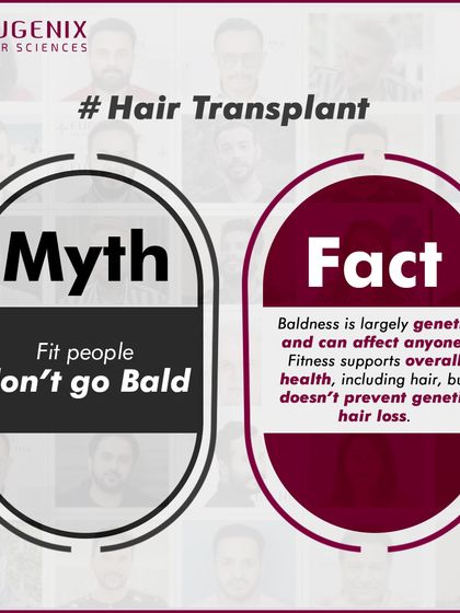 Myth: Fit people don't go bald. Fact: Baldness is largely determined by genetics and can affect anyone, regardless of their fitness level. While fitness supports overall health, it does not prevent genetic hair loss.