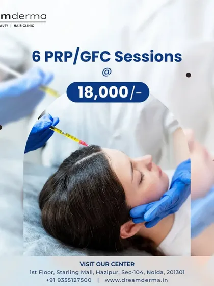 To make treatment more accessible, I offer packages like this one for six PRP or GFC sessions. Consistency is key for the best results, and this package is designed to provide a complete, effective, and affordable path to stronger, thicker hair.