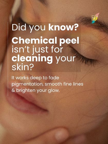 A chemical peel is much more than a deep cleaning treatment. It is a clinical procedure that works deep in the skin to fade pigmentation, smooth fine lines, and brighten your overall glow by promoting controlled exfoliation and cell turnover.