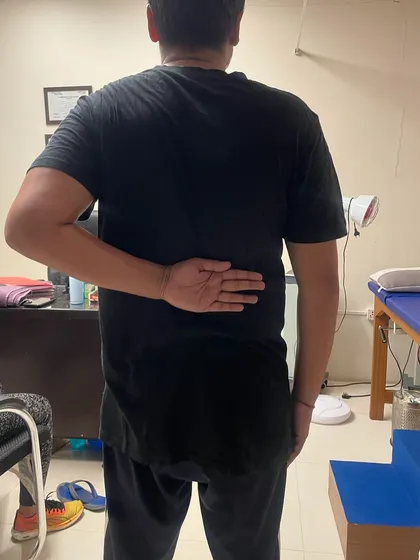 Here is Mr. Deepak after his 20-day treatment plan, demonstrating a significant increase in his ability to reach behind his back, a key functional movement.