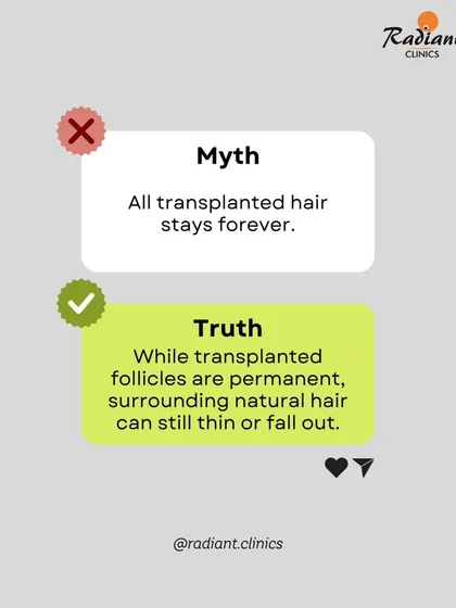 Myth: All transplanted hair stays forever. Truth: The follicles I transplant from the permanent donor zone are permanent. However, the surrounding native hair can continue to thin over time, which is why a long-term medical management plan is often necessary.