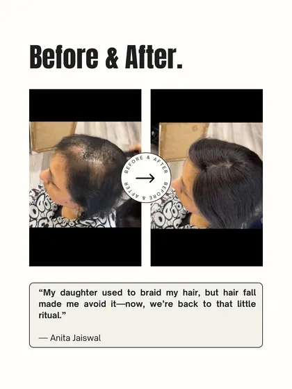 Simple moments like a daughter braiding her mother's hair are precious. Anita was able to bring back this cherished ritual after a hair topper restored the volume she had lost.