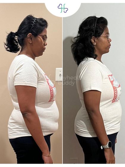 This client lost 5 kgs in 6 months by following a simple plan of home-cooked meals and regular workouts. She learned to make mindful choices and transitioned to a healthier lifestyle.