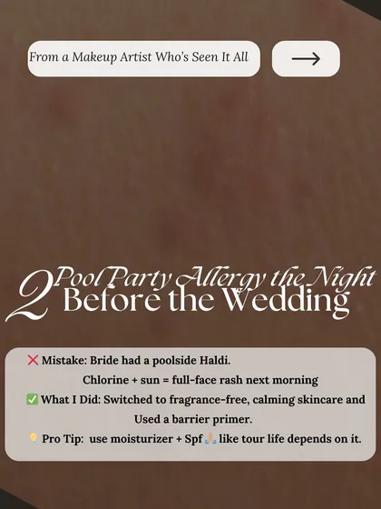 Bridal Emergency 2: A full-face rash from a poolside Haldi party. Pro tip: Chlorine and sun are a bad combination. Always use moisturizer and SPF like your life depends on it.