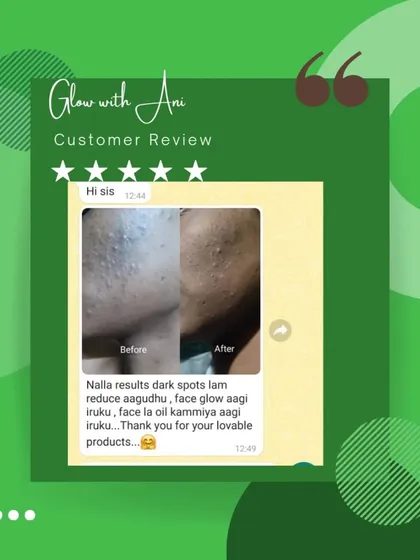 A picture is worth a thousand words. This before and after from a happy customer shows how my products helped reduce dark spots and control oiliness. This is the kind of change that makes me so happy.