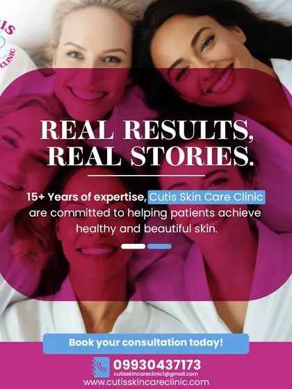 This image reinforces our clinic's credibility and experience. It highlights our 15+ years of expertise and our commitment to helping patients achieve healthy, beautiful skin through proven results.