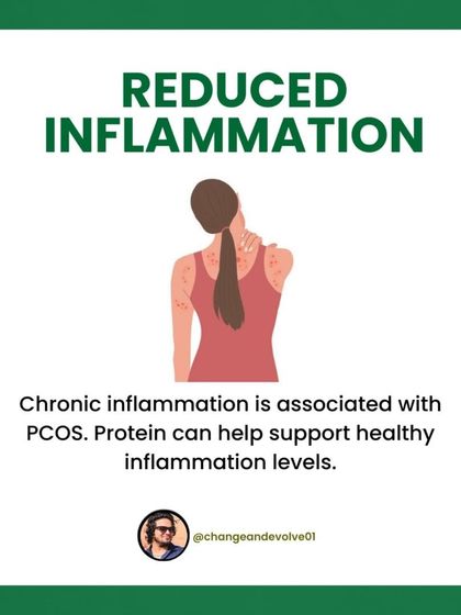A high-protein diet can help reduce chronic inflammation associated with PCOS.