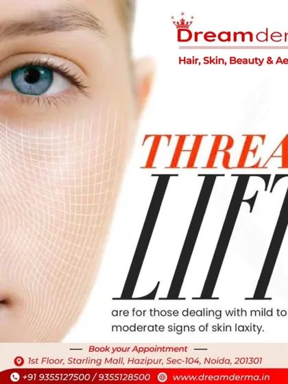 A Thread Lift is an excellent option for those dealing with mild to moderate skin laxity. This minimally invasive procedure provides an immediate lift and contour to the face by using dissolvable threads to support and elevate sagging tissue.