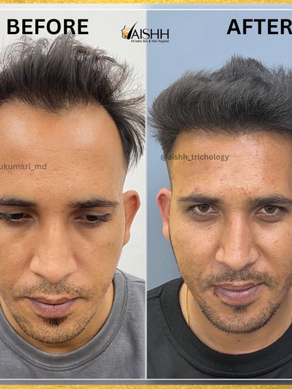 A direct before-and-after comparison, showcasing the dramatic and positive change in his appearance.
