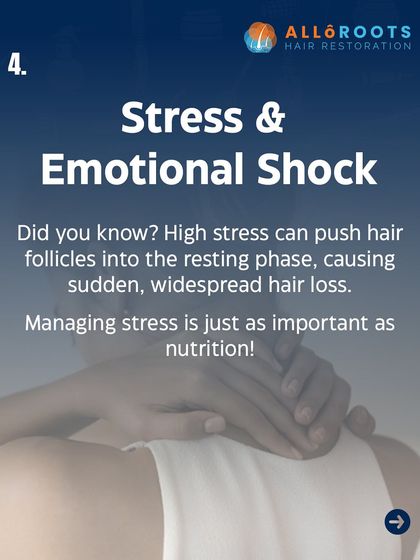 High levels of stress or an emotional shock can push a large number of hair follicles into the resting phase, causing sudden and widespread hair loss. Managing stress is just as important for your hair as nutrition.