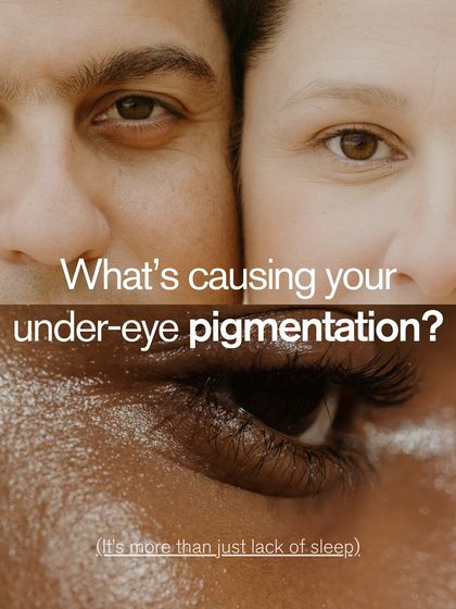 What's causing your under-eye pigmentation? It's more than just lack of sleep. My dermatologist-approved under-eye peels can help reduce pigmentation by targeting melanin and brightening the delicate area.