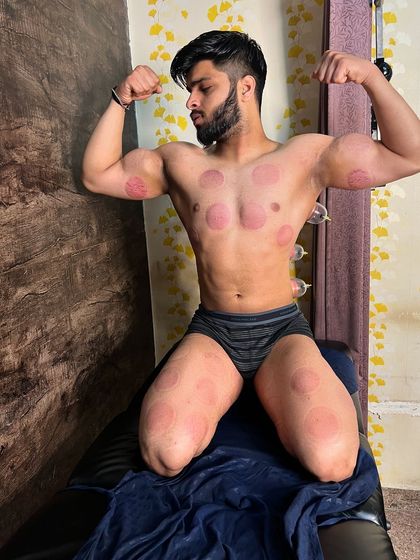 Another pose from a satisfied client after his cupping session.