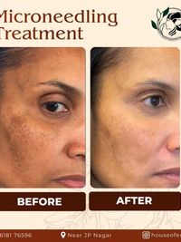 Aesthetic Skin Treatments