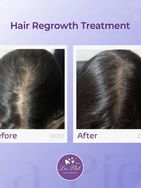 Hair Restoration & Scalp Care