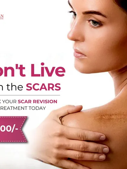 You don't have to live with scars. My scar revision treatments are an affordable and effective way to begin your journey toward smoother, clearer skin.