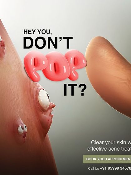 It can be tempting, but please don't pop your pimples. Popping can lead to more inflammation, infection, and permanent scarring. I offer effective acne treatments that heal breakouts safely.