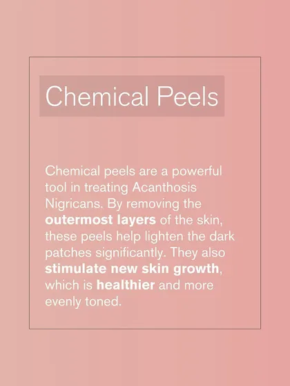 Chemical peels are a powerful tool for treating Acanthosis Nigricans. By removing the outermost layers of skin, these peels help lighten the dark patches and stimulate new, healthier skin growth.