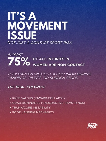 Almost 75% of ACL injuries in women are non-contact, meaning they are movement issues. The real culprits are often knee valgus (inward collapse), poor landing mechanics, and core instability, all of which we target in our training.