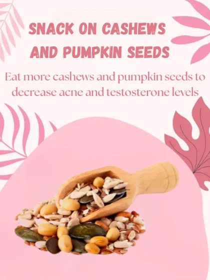 To manage PCOD related acne and high testosterone levels, I recommend snacking on cashews and pumpkin seeds. These are rich in nutrients that support skin health and hormonal balance.