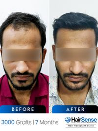 Hair Transplant & Restoration Surgery