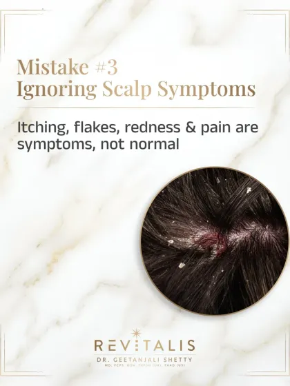 Itching, flakes, and redness are not normal. These are symptoms of an underlying scalp issue like seborrheic dermatitis or fungal infections. Ignoring them allows the problem to worsen and can impact hair growth.