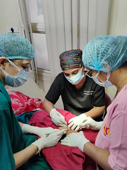 This is a glimpse into a vitiligo surgery. Performing procedures like mini punch grafting requires precision and expertise. It’s a privilege to use these advanced dermatosurgery techniques to help my patients regain not just their skin tone, but their confidence.