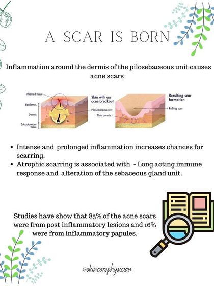A scar is born from inflammation in the skin. Intense and prolonged inflammation, often from cystic acne or picking, increases the likelihood of scarring.