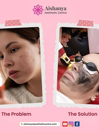 This graphic illustrates the problem of common skin concerns and presents my clinic as the solution. I am here to help you achieve your beauty goals with personalized care.