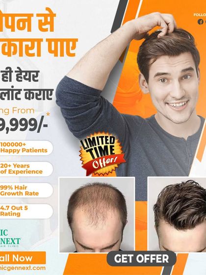 Get rid of baldness today with a hair transplant starting from 29,999. This is a limited-time offer from my clinic, backed by 20+ years of experience and over 100,000 happy patients.