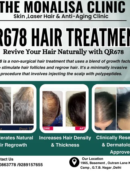 Our QR678 hair treatment is a patented, non-surgical solution for stubborn hair loss. The before and after images show significant improvement in hair density and scalp coverage after a few sessions.