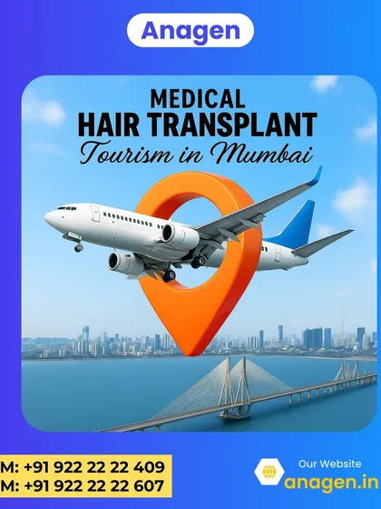 We make your hair transplant journey to Mumbai completely seamless. This image represents our all inclusive medical tourism package, where we handle everything from your airport pickup to your premium hotel stay, so you can focus solely on your transformation.