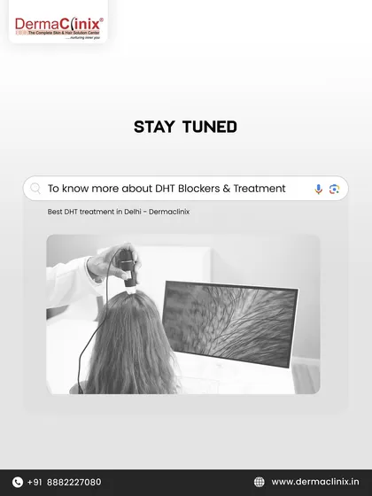 Stay tuned to learn more about DHT blockers and treatments. An early scalp analysis can make all the difference.