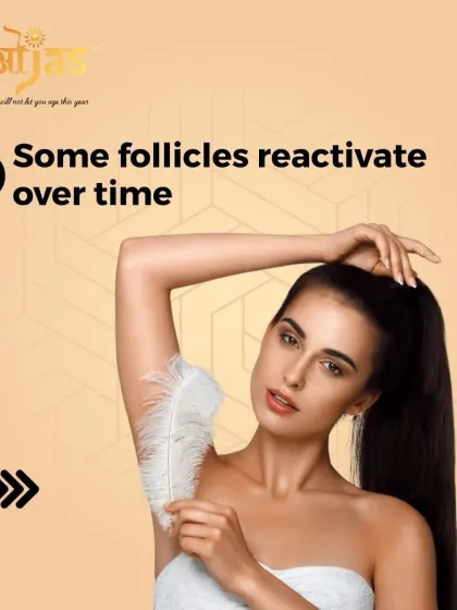 Over time, due to hormonal changes or other factors, some dormant hair follicles can become active again. This is why maintenance sessions are important for long-term smoothness.
