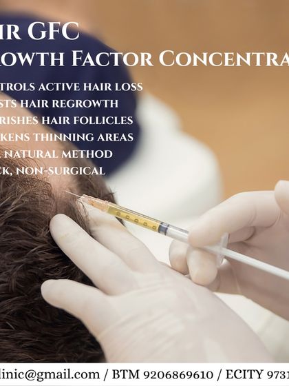 Vitals Klinic - Hair Restoration & Treatment Non-Surgical Hair Regrowth: PRP & GFC Therapy photo 3