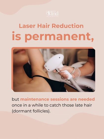 While laser hair reduction is permanent, occasional maintenance sessions are needed to target any new hair from dormant follicles that may activate over time due to hormonal changes.