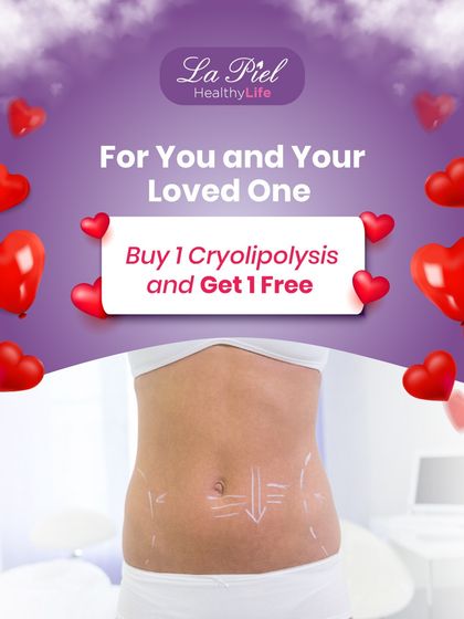 I often provide special offers to make treatments more accessible, such as this Valentine's promotion for Cryolipolysis, a popular fat-freezing procedure. This non-invasive treatment is an effective way to target and eliminate fat cells in specific areas.