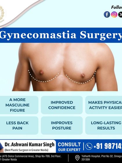 Gynecomastia surgery offers many benefits beyond just appearance. It can lead to improved confidence, less back pain, better posture, and makes physical activities easier. The results are long-lasting.