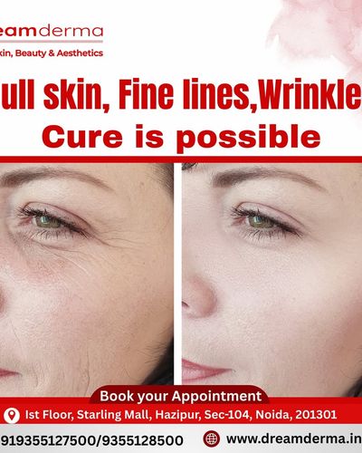 Anti-Aging & Facial Rejuvenation