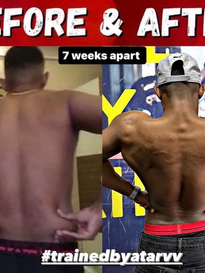 The back development after just 7 weeks. We stripped away fat to reveal the underlying muscle, creating a V-taper and detailed back.