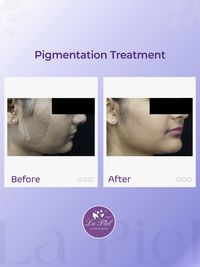 Advanced Skin Rejuvenation & Glow Treatments