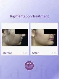 Advanced Skin Rejuvenation & Glow Treatments