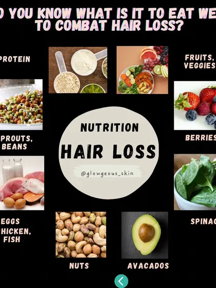 **Nutrition is key in the fight against hair loss.** This graphic highlights the importance of a diet rich in protein, fruits, veggies, and healthy fats from sources like nuts and avocados. A balanced plate supports healthy hair follicles.