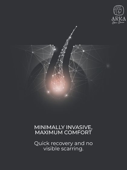 Our FUE technique is minimally invasive, which means a quick recovery and no visible linear scarring. We prioritize your comfort throughout the entire process, from the initial consultation to the final follow-up.