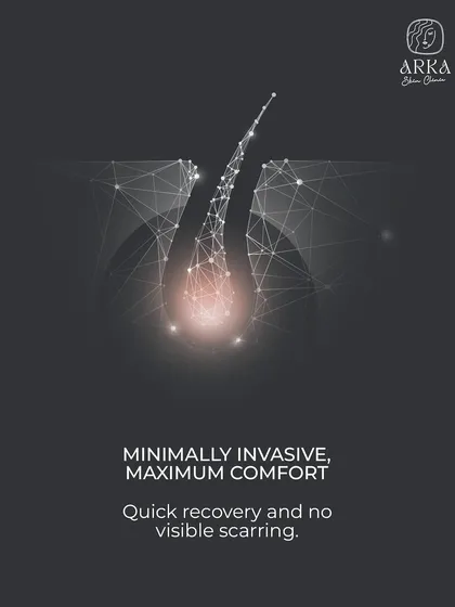 Our FUE technique is minimally invasive, which means a quick recovery and no visible linear scarring. We prioritize your comfort throughout the entire process, from the initial consultation to the final follow-up.