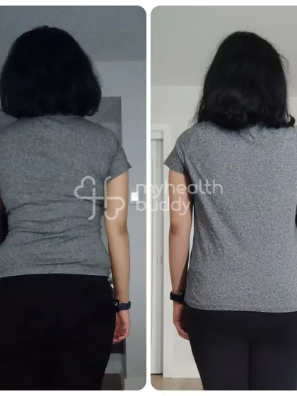 After trying many diets, this client finally learned how to lose weight sustainably, losing 7 kgs in 6 months and gaining energy.
