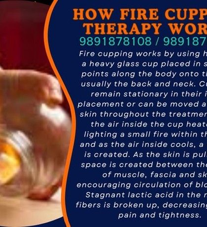 A detailed look at the mechanism of fire cupping. The heat and vacuum work together to pull on muscle and fascia, encouraging circulation and breaking down tightness. It's a powerful, ancient technique with modern applications.