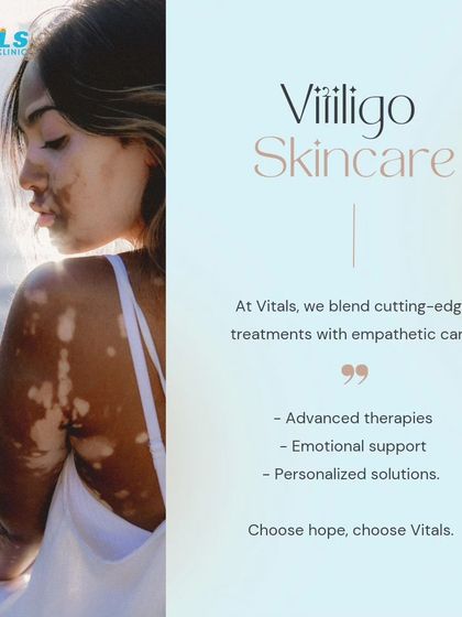 Vitals Klinic - Medical Dermatology Vitiligo & Pigment Restoration photo 10