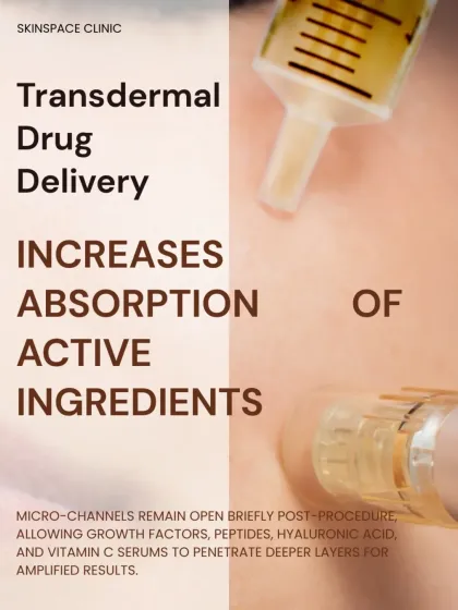 Microneedling enhances transdermal drug delivery. The micro-channels created during the procedure remain open briefly, allowing active ingredients like growth factors, peptides, and hyaluronic acid to penetrate deeper for amplified results.
