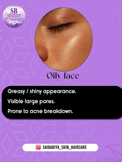 A close-up visual of what oily skin looks like. It's characterized by a shiny surface and enlarged pores, often leading to breakouts. My oil-control range is made specifically for this.