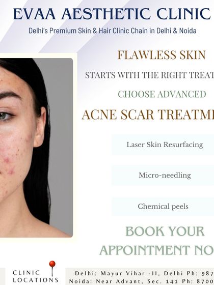 Flawless skin begins with the right treatment. This graphic lists our advanced acne scar treatments, including laser skin resurfacing, microneedling, and chemical peels.